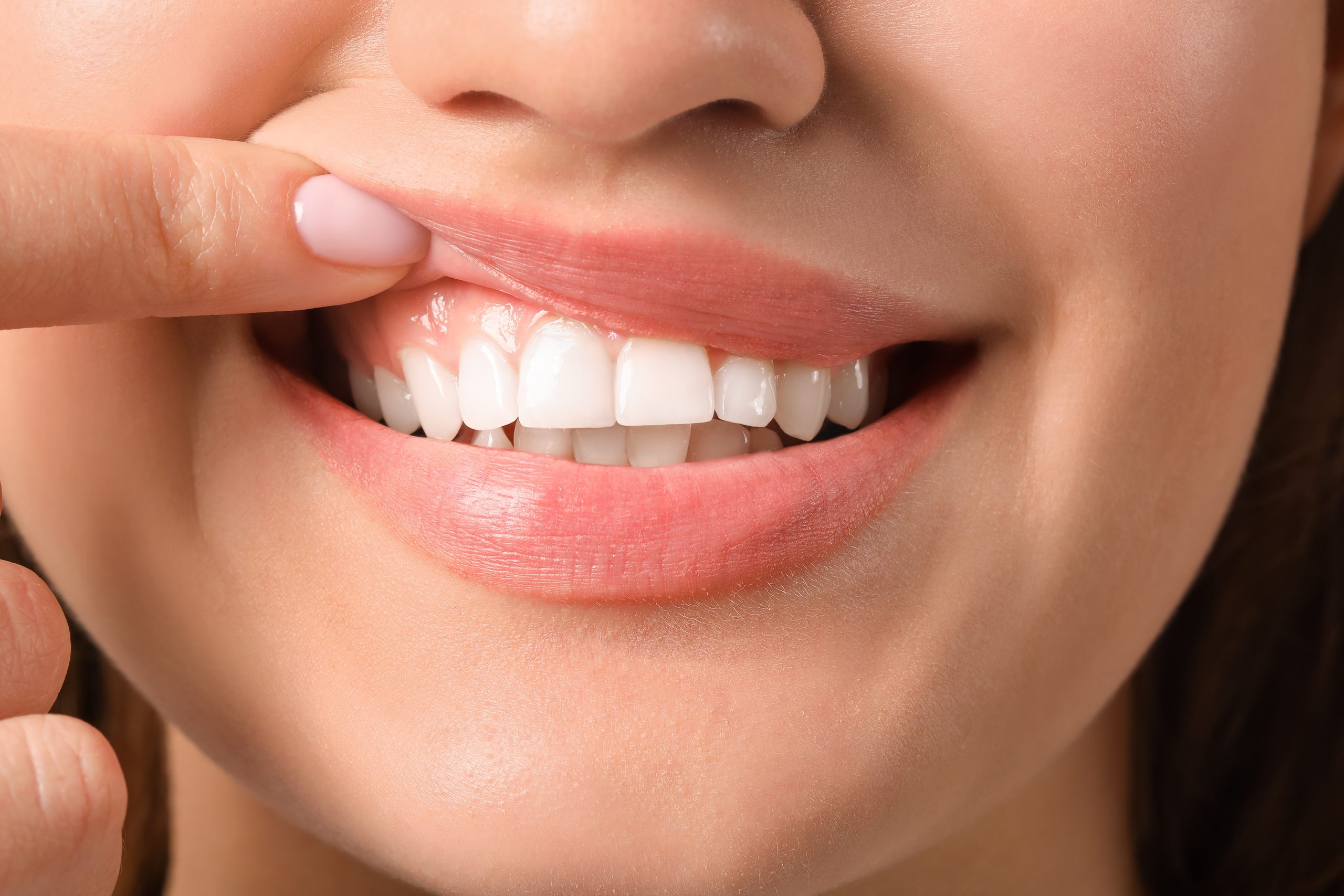 Woman showing healthy pink gums for National Gum Care Month, Imperial Dental Center, Sugar Land TX