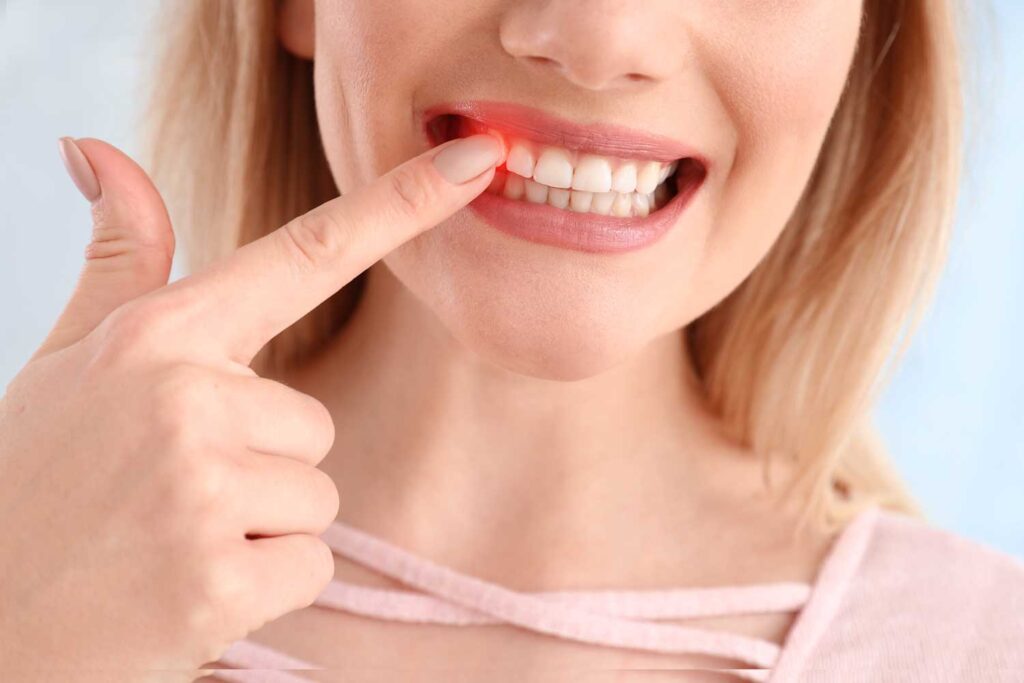 Common Causes for Bleeding Gums Best Dentist Sugar Land Texas